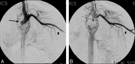 Fig 5.