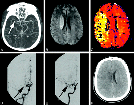 Fig 6.