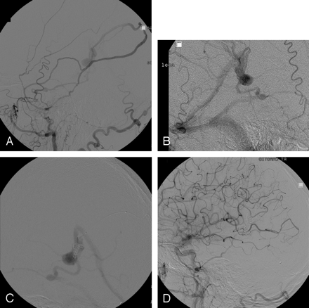 Fig 2.