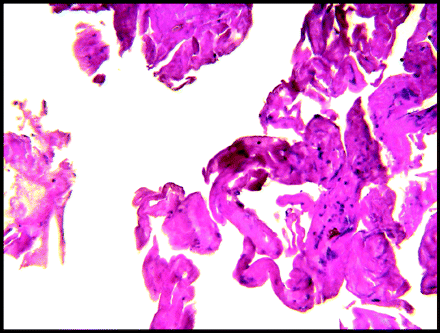 Fig 4.
