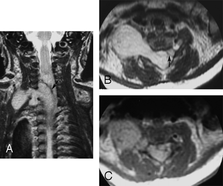 Fig 2.