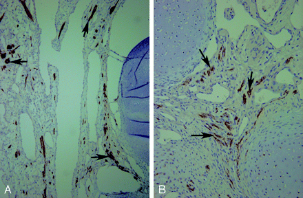 Fig 4.