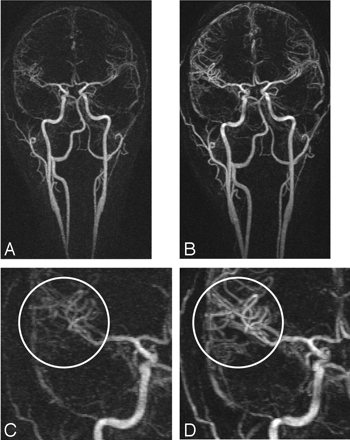 Fig 3.
