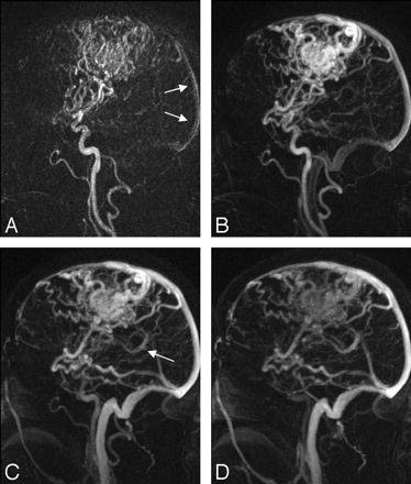 Fig 6.