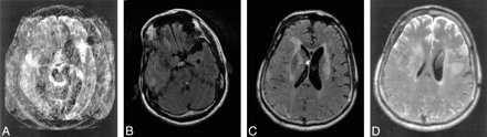 Fig 5.