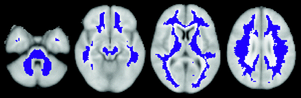 Fig 1.