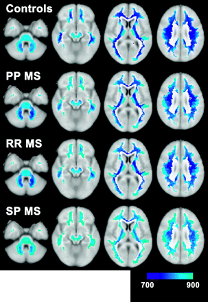 Fig 2.
