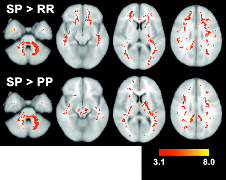 Fig 4.