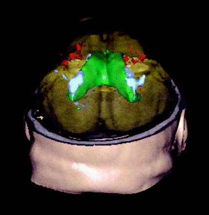 Fig 2.