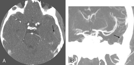 Fig 2.