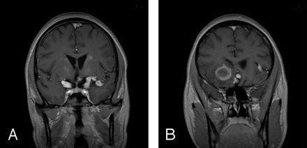 Fig 4.