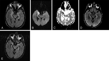 Fig 1.