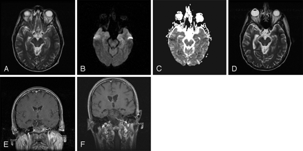 Fig 2.