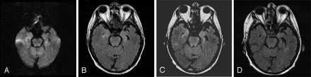 Fig 3.