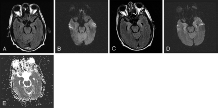 Fig 4.