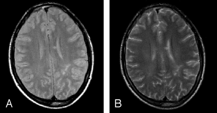 Fig 2.