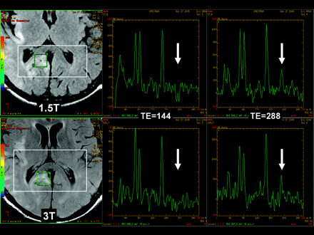 Fig 3.