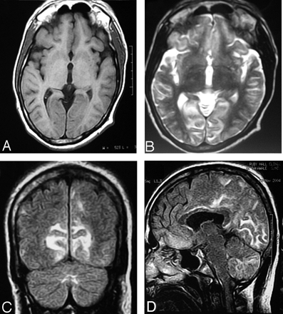 Fig 1.
