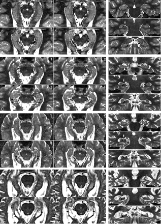 Fig 3.