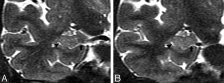 Fig 4.