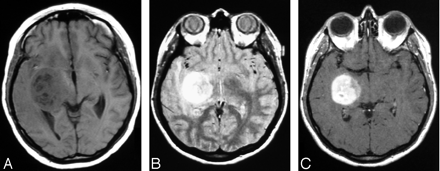 Fig 1.