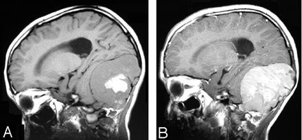 Fig 3.