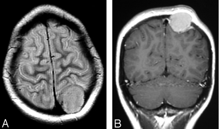 Fig 4.