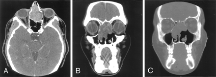 Fig 1.