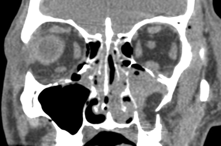 Fig 2.