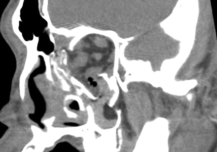 Fig 3.