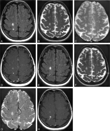 Fig 1.