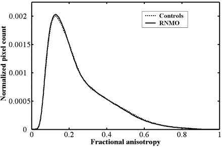 Fig 3.