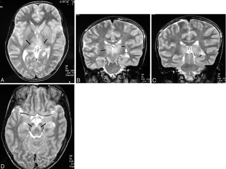 Fig 1.