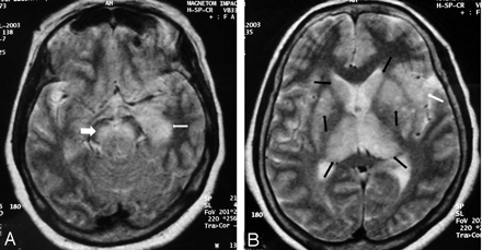 Fig 3.