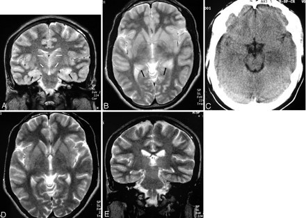 Fig 4.