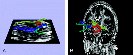 Fig 3.