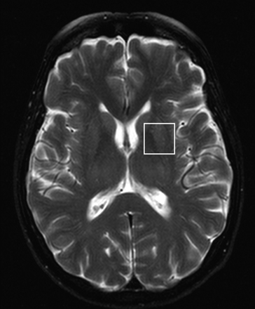 Fig 2.
