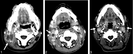 Fig 1.
