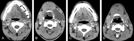 Fig 1.