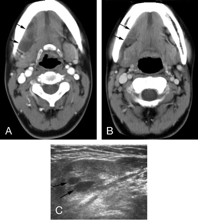Fig 2.