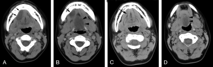 Fig 4.
