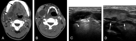 Fig 5.