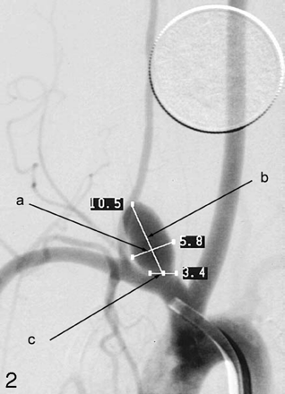 Fig 2.