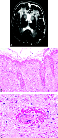 Fig 3.