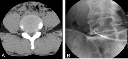 Fig 1.