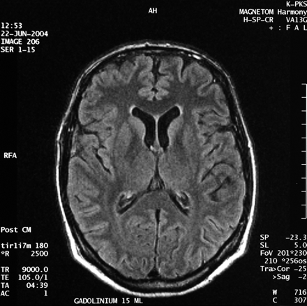 Fig 1.