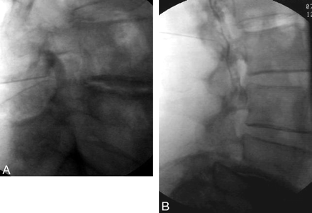 Fig 3.