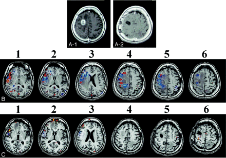 Fig 4.