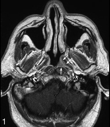Fig 1.