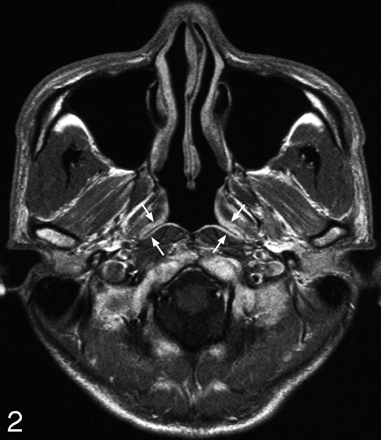 Fig 2.